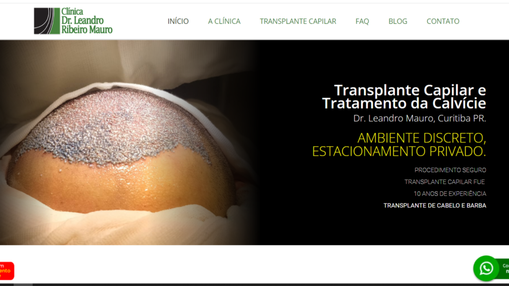 maior site de transplante capilar neuro marketing curitiba